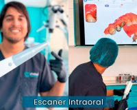 Escaner Intraoral